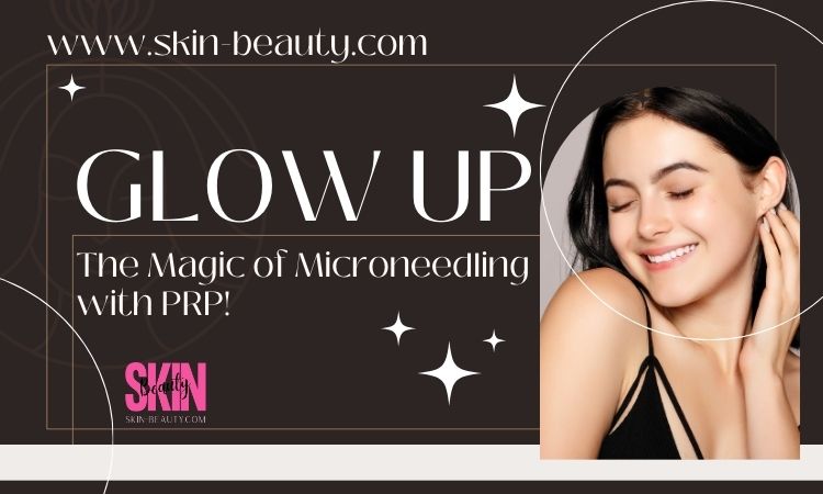 Skin Beauty Microneedling with PRP: Glow Up
