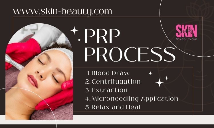 Skin Beauty Microneedling with PRP Process