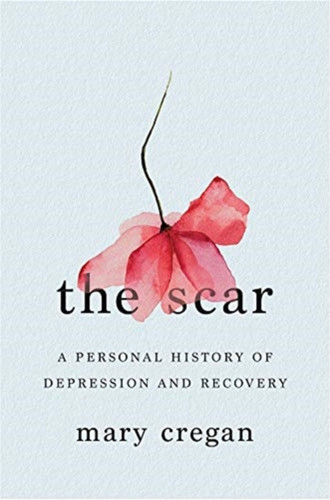 The Scar 9781324001720 Hardback