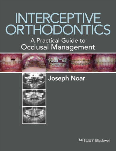 Interceptive Orthodontics 9780470656211 Paperback Interceptive Orthodontics 9780470656211 Paperback