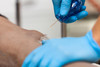 Prometheus PIN ® Intraosseous Needle (IO) Prometheus PIN ® Intraosseous Needle (IO)