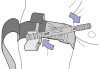 CAT Combat Application Tourniquet Tactical Black Gen 7
