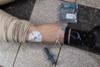 GO-IO Intraosseous Start Kit