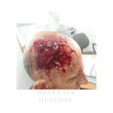 WoundClot MEDLIFE hämostatische Gaze, medizinischer Notfallverband zur schnellen Blutstillung – Helvetia Defense