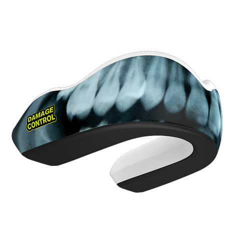 Mouth Guard Protection - Damage Control Mouthguards