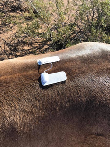 Microcurrent Therapy