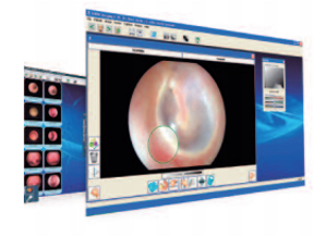 CAMEX ENDOVIEW SOFTWARE LICENCE ONCD. FOR USE WITH HICAM AEC 507005FX AND507015FXSOFTWARE FEATURES INCL.
- transfer of video data into a Windows PC or Laptop
- recording of video still images
- recording of videos w. basic video cutting
- recording o