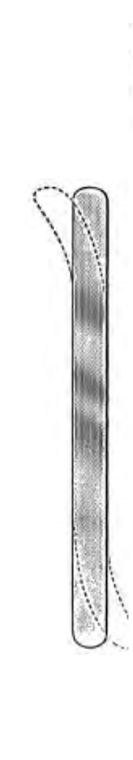 PEDIATRIC Ribbon Retractor, 1/4" Wide, (0.6cm), Satin, (17.8cm) 7"