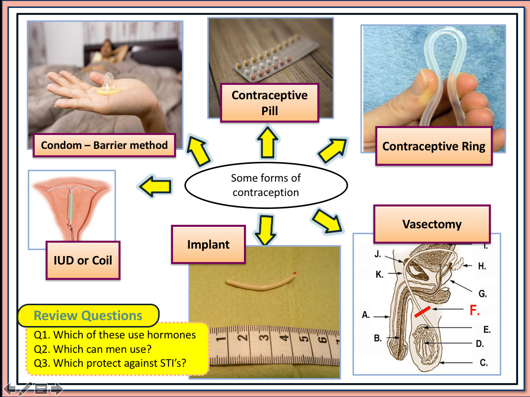 Introduction to Contraception - Amped Up Learning