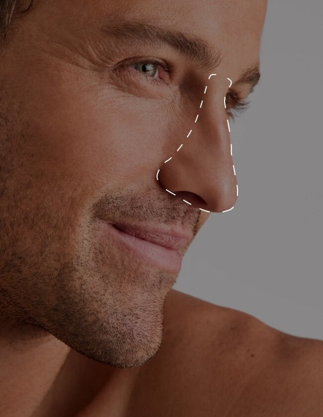 Nose Laser Hair Removal | Laser Clinics New Zealand