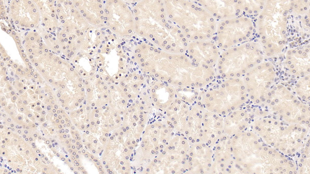 Msra Humans Methionine Sulfoxide Reductase A (MSRA) Monoclonal Antibody, Cat# ...