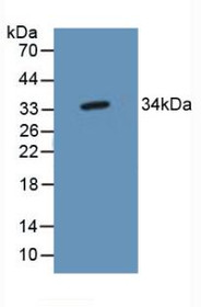 Western Blot; Sample: Mouse Brain Tissue.