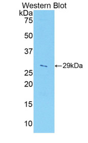 Western Blot; Sample: Recombinant protein.