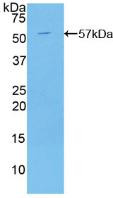 Western Blot; Sample: Recombinant C2CD3, Human.