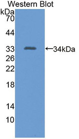 Western Blot; Sample: Recombinant protein.