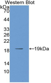 Western Blot; Sample: Recombinant protein.