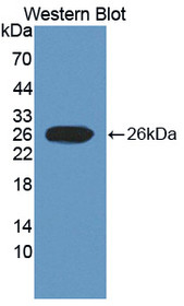 Western Blot; Sample: Recombinant protein.
