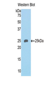 Western Blot; Sample: Recombinant protein.