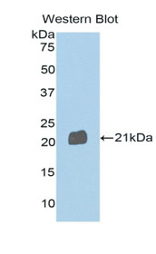 Western Blot; Sample: Recombinant protein.