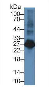 Western Blot; Sample: Rat Spleen lysate; Primary Ab: 2µg/ml Rabbit Anti-Rat LAT2 Antibody Second Ab: 0.2µg/mL HRP-Linked Caprine Anti-Rabbit IgG Polyclonal Antibody