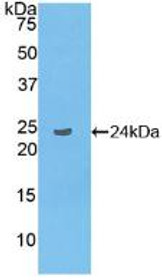 Western Blot; Sample: Recombinant LAT2, Human.