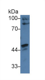Western Blot; Sample: Human HepG2 cell lysate; Primary Ab: 3µg/ml Rabbit Anti-Human CARD9 Antibody Second Ab: 0.2µg/mL HRP-Linked Caprine Anti-Rabbit IgG Polyclonal Antibody