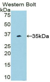 Western Blot; Sample: Recombinant protein.