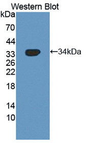 Western Blot; Sample: Recombinant protein.