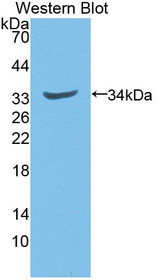 Western Blot; Sample: Recombinant protein.
