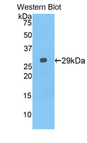 Western Blot; Sample: Recombinant protein.