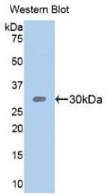 Western Blot; Sample: Recombinant protein.