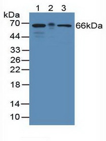 Western Blot; Sample: Lane1: Mouse Brain Tissue; Lane2: Mouse Large Intestine Tissue; Lane3: Human Hela Cells.