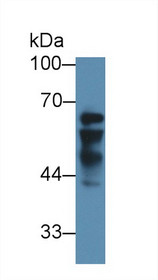 Western Blot; Sample: Human Liver lysate; Primary Ab: 3µg/ml Rabbit Anti-Human IGF2BP2 Antibody Second Ab: 0.2µg/mL HRP-Linked Caprine Anti-Rabbit IgG Polyclonal Antibody