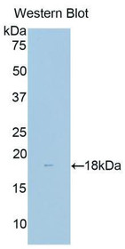 Western Blot; Sample: Recombinant protein.