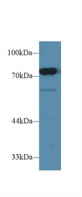Western Blot; Sample: Rat Testis lysate; Primary Ab: 1µg/ml Rabbit Anti-Rat CD2AP Antibody Second Ab: 0.2µg/mL HRP-Linked Caprine Anti-Rabbit IgG Polyclonal Antibody