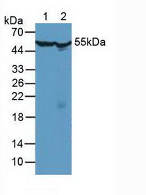 Western Blot; Sample: Lane1: Human Hela Cells; Lane2: Mouse Testis Tissue.