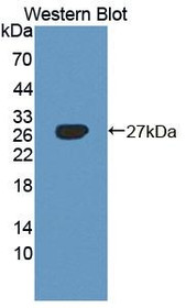 Western Blot; Sample: Recombinant protein.