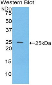 Western Blot; Sample: Recombinant protein.