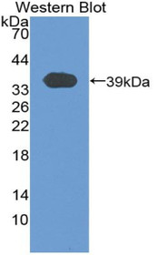 Western Blot; Sample: Recombinant protein.