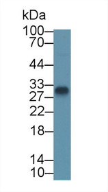 Western Blot; Sample: Rat Serum; Primary Ab: 2µg/ml Rabbit Anti-Rat TMEM27 Antibody Second Ab: 0.2µg/mL HRP-Linked Caprine Anti-Rabbit IgG Polyclonal Antibody