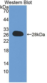 Western Blot; Sample: Recombinant protein.