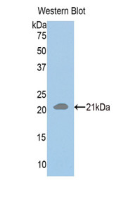 Western Blot; Sample: Recombinant protein.