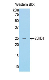 Western Blot; Sample: Recombinant protein.