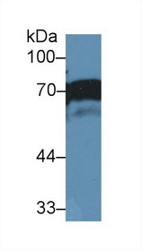Western Blot; Sample: Human A431 cell lysate; Primary Ab: 2µg/ml Rabbit Anti-Human NUMB Antibody Second Ab: 0.2µg/mL HRP-Linked Caprine Anti-Rabbit IgG Polyclonal Antibody