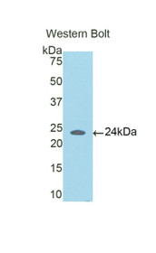 Western Blot; Sample: Recombinant protein.