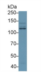 Western Blot; Sample: Human Hela cell lysate; Primary Ab: 1µg/ml Rabbit Anti-Human PIK3Cb Antibody Second Ab: 0.2µg/mL HRP-Linked Caprine Anti-Rabbit IgG Polyclonal Antibody