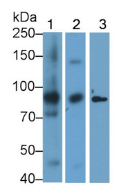 Western Blot; Sample: Recombinant protein.