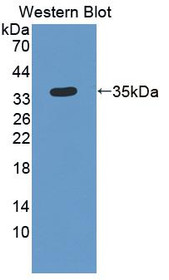 Western Blot; Sample: Recombinant protein.