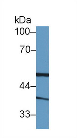 Western Blot; Sample: Human Lung lysate; Primary Ab: 1µg/ml Rabbit Anti-Human BLVRA Antibody Second Ab: 0.2µg/mL HRP-Linked Caprine Anti-Rabbit IgG Polyclonal Antibody