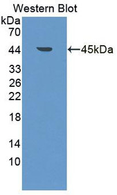 Western Blot; Sample: Recombinant protein.